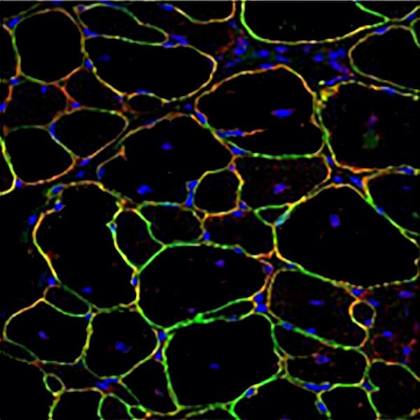 Immunofluorescence image showing the sarcolemmal localization of micro-dystrophin using DSHB antibody MANEX1011B (1C7) anti-dystrophin (green) in a treated mdx-AAV-Dys mouse. PMID: 27570057, Fig. 4B.